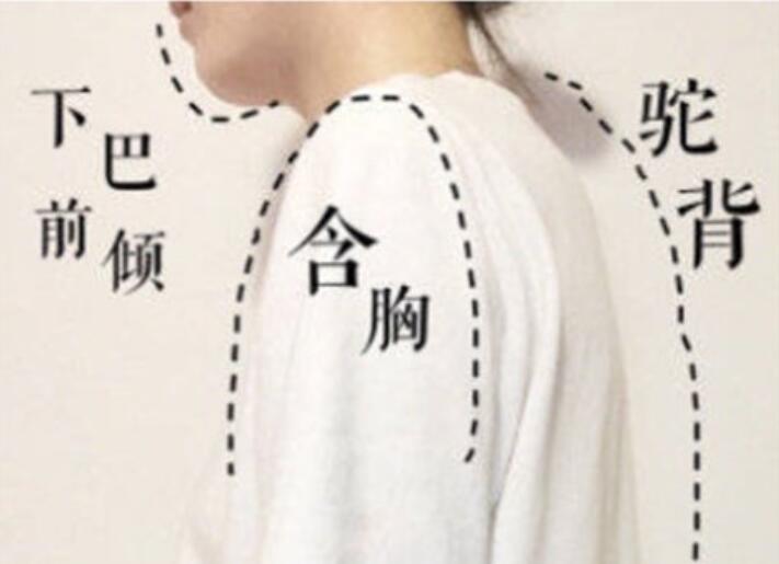 南寧美容學(xué)校：堅持一個月，駝背變直背