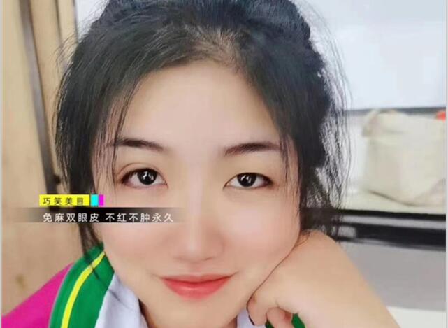 麗竹學(xué)?！凹y繡+雙眼皮”課程開講