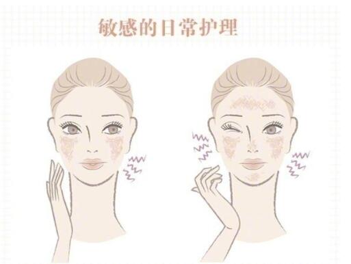敏感肌保養(yǎng)大全！
