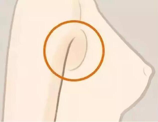 減副乳，瘦手臂一招就解決！