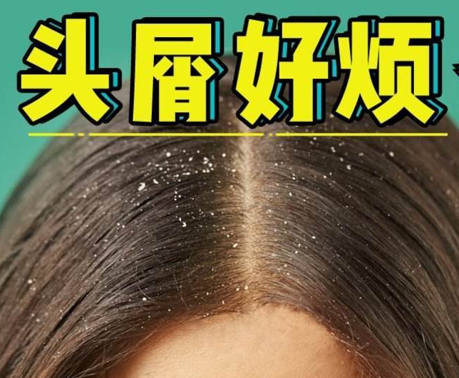 南寧正規(guī)美發(fā)培訓學校分享：冬天如何減少頭屑過多？