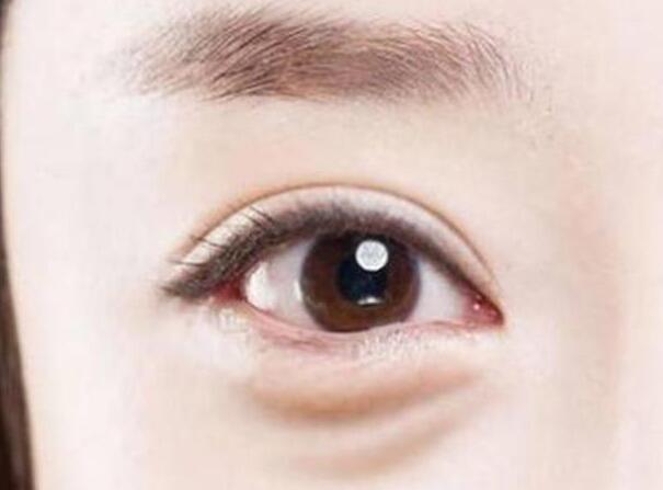 眼袋？淚溝？臥蠶？南寧美容學(xué)校教你辨別