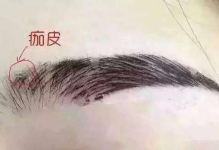 紋眉結(jié)痂時(shí)要注意什么？麗紋竹繡學(xué)校教你