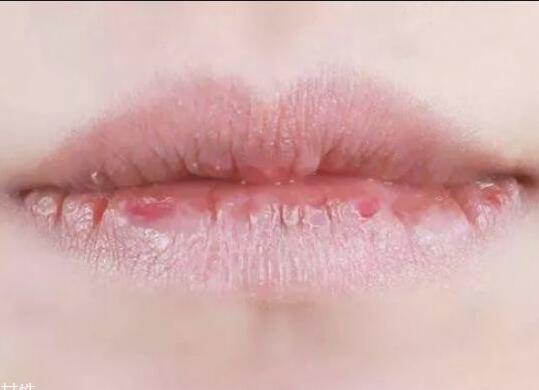 紋唇后嘴巴干燥怎么辦？南寧教紋繡的學(xué)校幫你解決