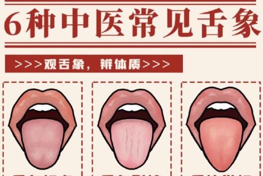 6種常見中醫(yī)舌診判定，快和廣西中醫(yī)美容一起學(xué)