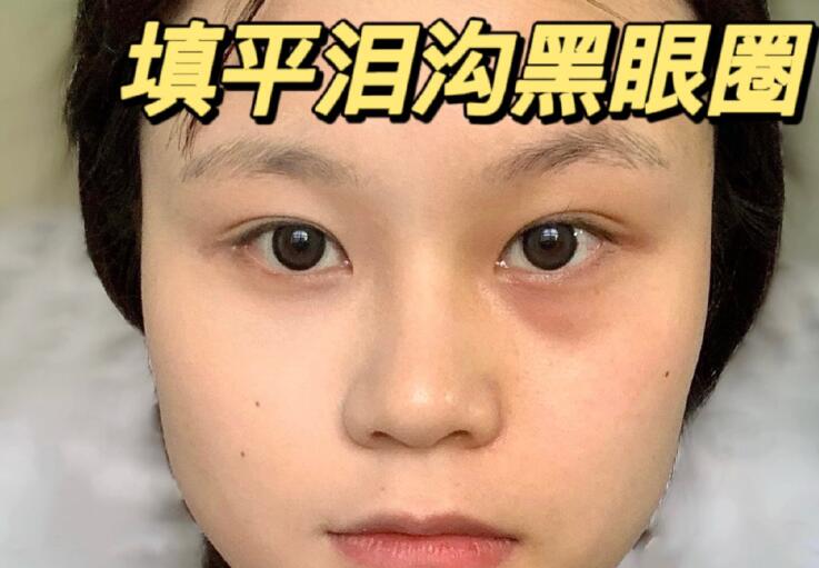 填平淚溝黑眼圈教程，廣西南寧化妝學(xué)校分享