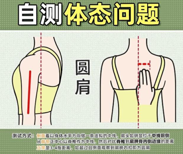 你真的是駝背嗎？廣西美容美體學校教你自測
