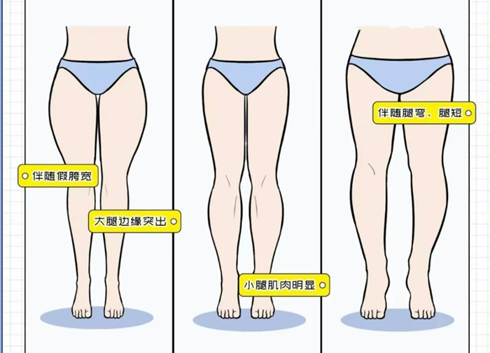 腿粗女生穿搭攻略，廣西彩妝造型搭配