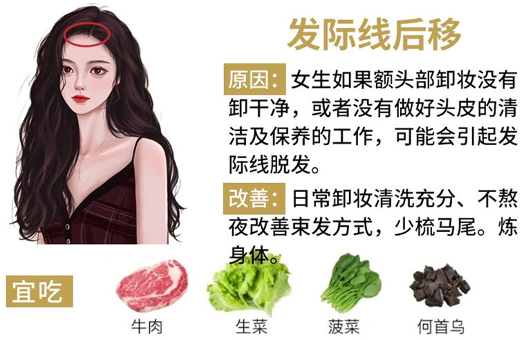 如何改善掉頭發(fā)？南寧頭療養(yǎng)發(fā)護發(fā)教學(xué)