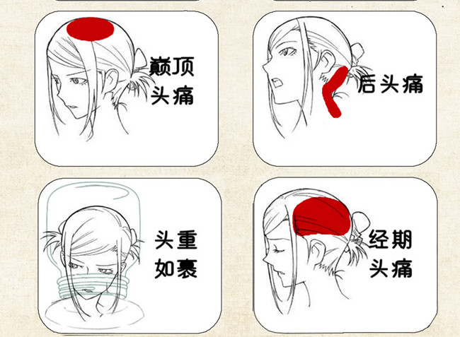 不同頭痛類型經(jīng)絡(luò)護(hù)理方法，廣西中醫(yī)美容培訓(xùn)