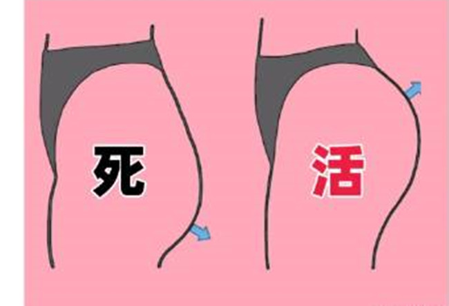 如何改善你臀部的健康情況？南寧美容形象